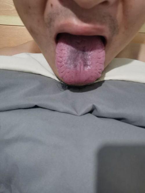 吃瓜舌头辣痛,揭秘辣度背后的秘密